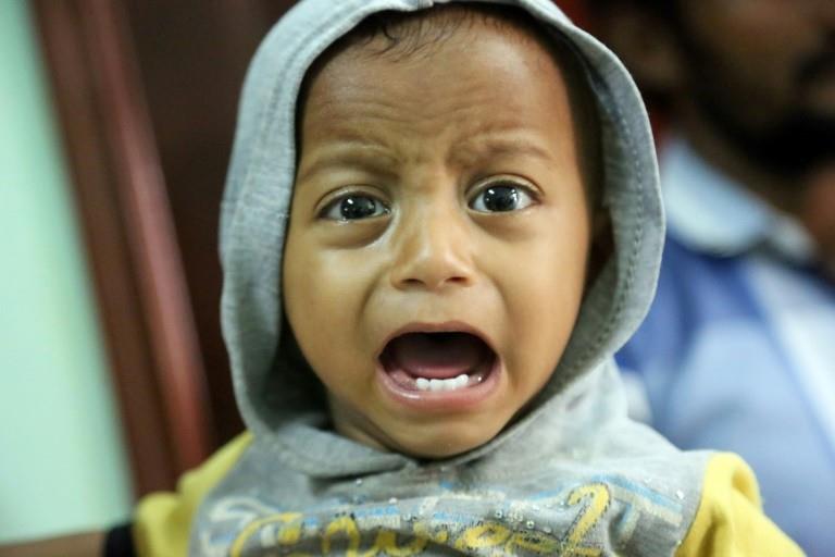  A child cries on November 5, 2017 at a hospital in the coastal city of Hodeidah in Yemen, where years of war have caused a widespread humanitarian crisis