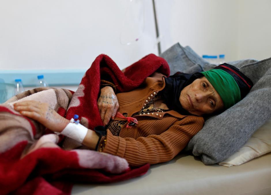 A woman with suspected cholera infection lies on a bed at a cholera treatment center in Sanaa.