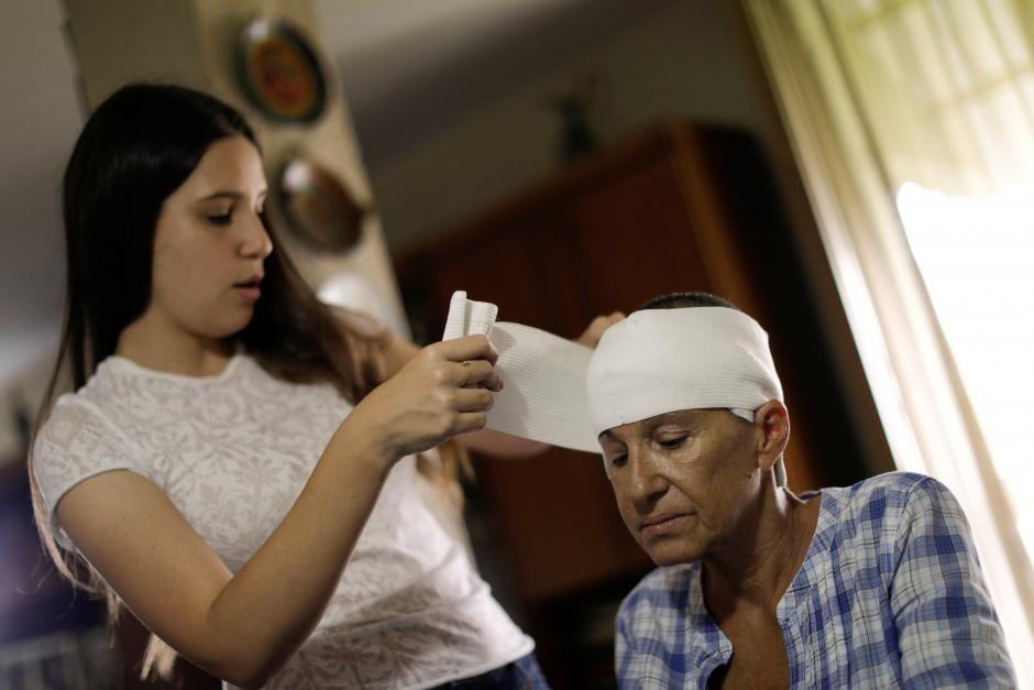 Yolyter Rodriguez, 56, a housewife and a mother-of-three, who was injured during a protest against Venezuela's President Nicolas Maduro's government, has her head bandaged by her daughter at her home in Caracas, Venezuela, August 11, 2017.