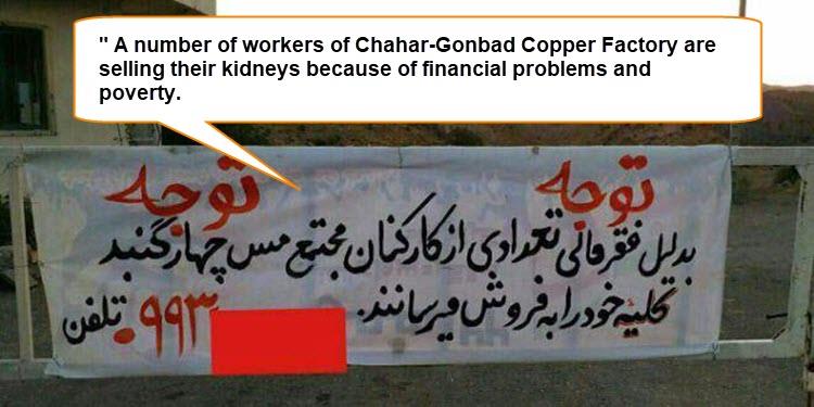 A number of workers of Chahar-Gonbad Copper Factory are selling their kidneys because of financial problems and poverty