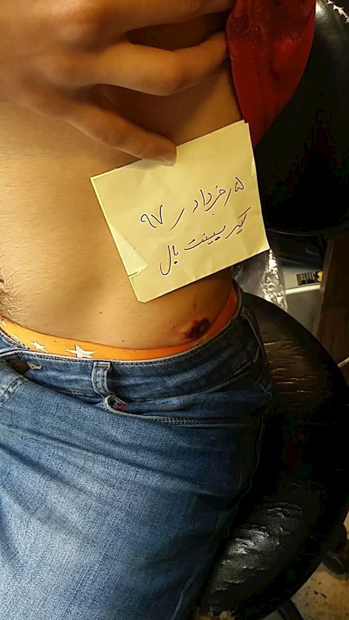 Plice opening fire on protesters