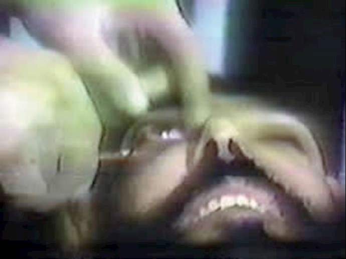 Iranian court sentences man to be blinded by acid