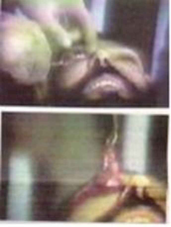 “An eye for an eye” – Iran to carry out gruesome punishment