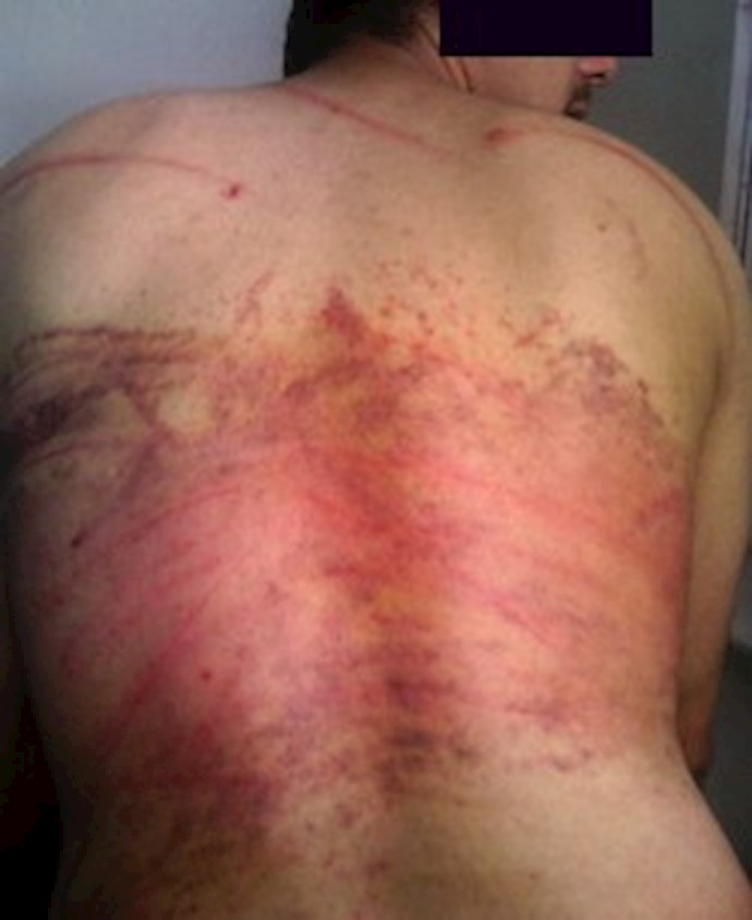 Uprising detainees tortured to death in prisons