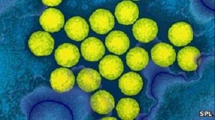 Polio outbreak fears in war-ravaged Syria