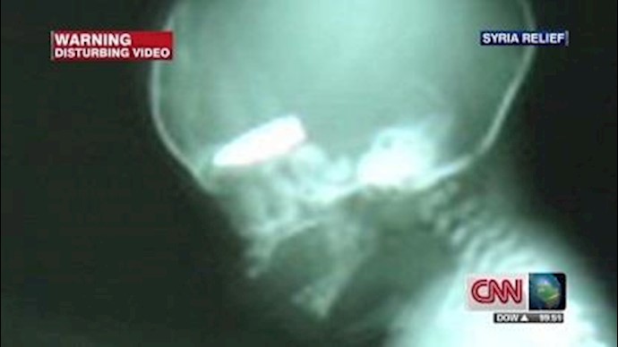 Syrian snipers target pregnant women, unborn babies, doctor says