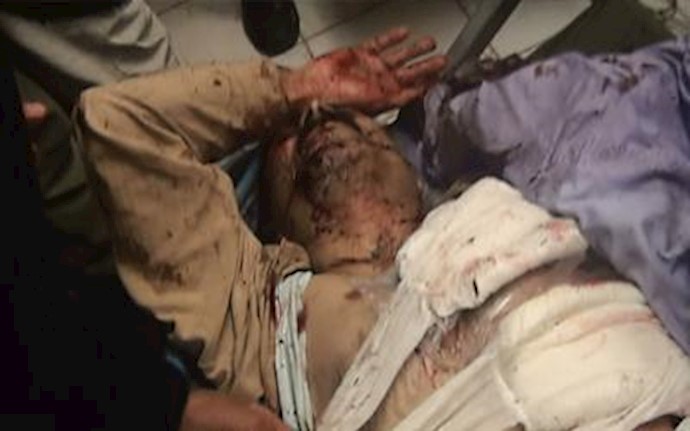 Dozens of PMOI residents killed and wounded in missile attack Dozens of PMOI residents killed and wounded in missile attack