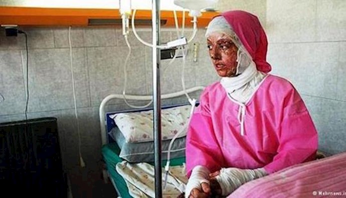  'Acid attack victim in Isfahan'