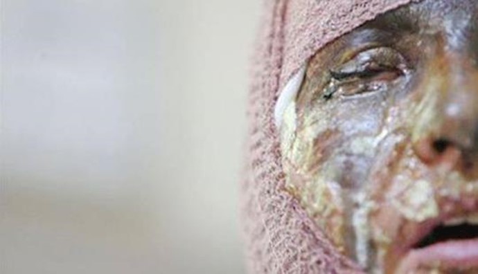 Iran: NCRI Women’s Committee calls for protests against acid attack on Iranian women
