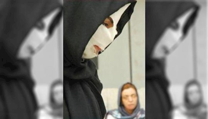 Iranian officials’ denial of knowing anything about acid attack on women
