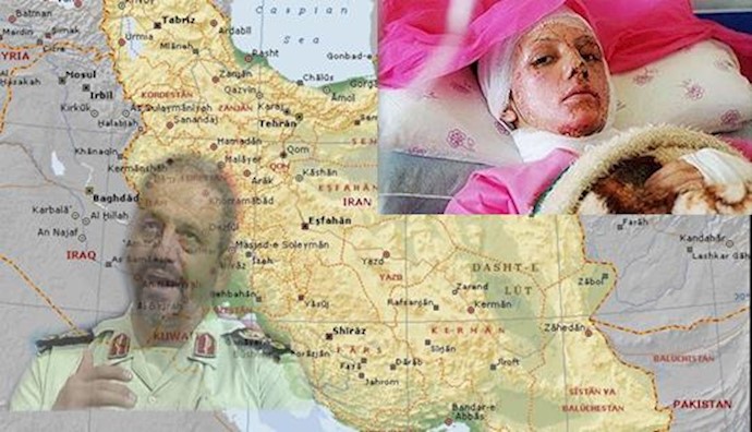  '380 cases of Acid Attack in less than one year in Iran'
