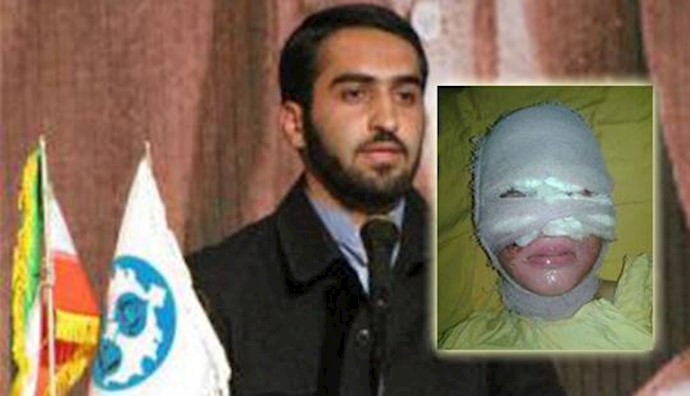  'Iran highest authorities try to cover up acid attacks'