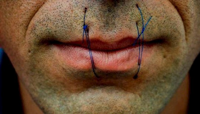 Iran: Kurdish prisoner sows lips in Kermanshah Prison