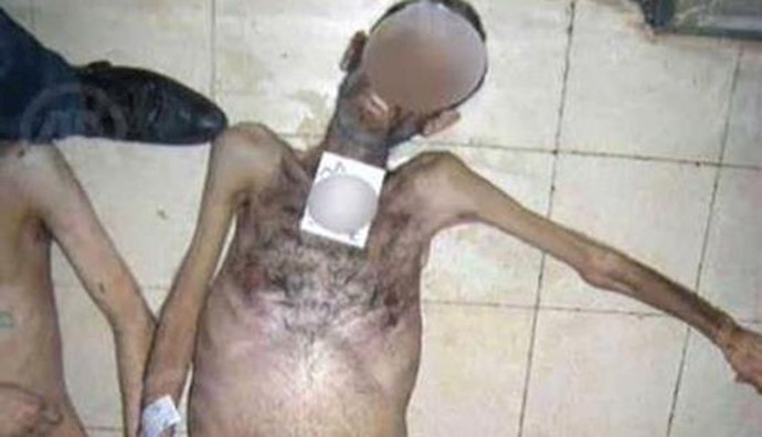 55,000 images of 11,000 victims of Assad regime presented to US Congress