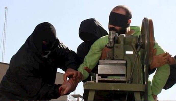 Secret amputation of 5 men’s hands in Iran under Rouhani