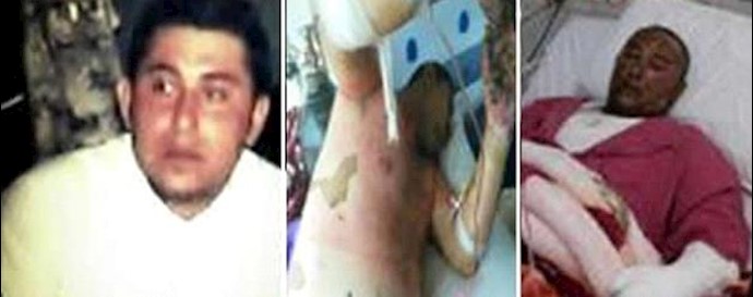 Iran; the young Khuzestani young man who set himself alight last week died