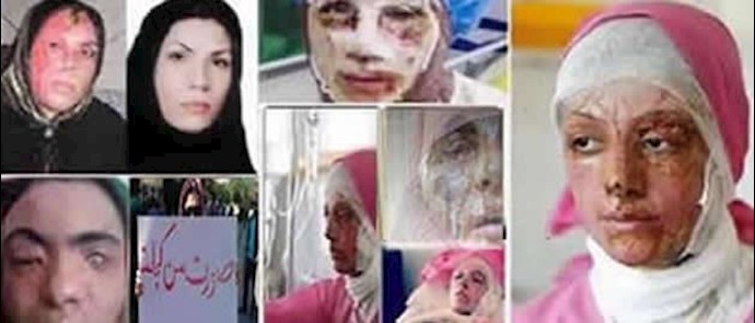  'Acid splashing is crime'