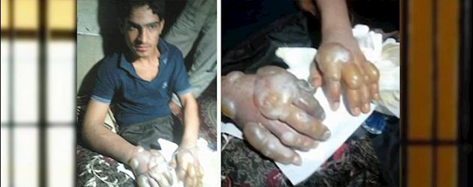 Iran suppressive security forces tortured a prisoner in the presence of the judge