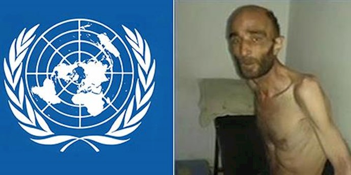 U.N. official: “We have seen with our own eyes severely malnourished children” in Madaya