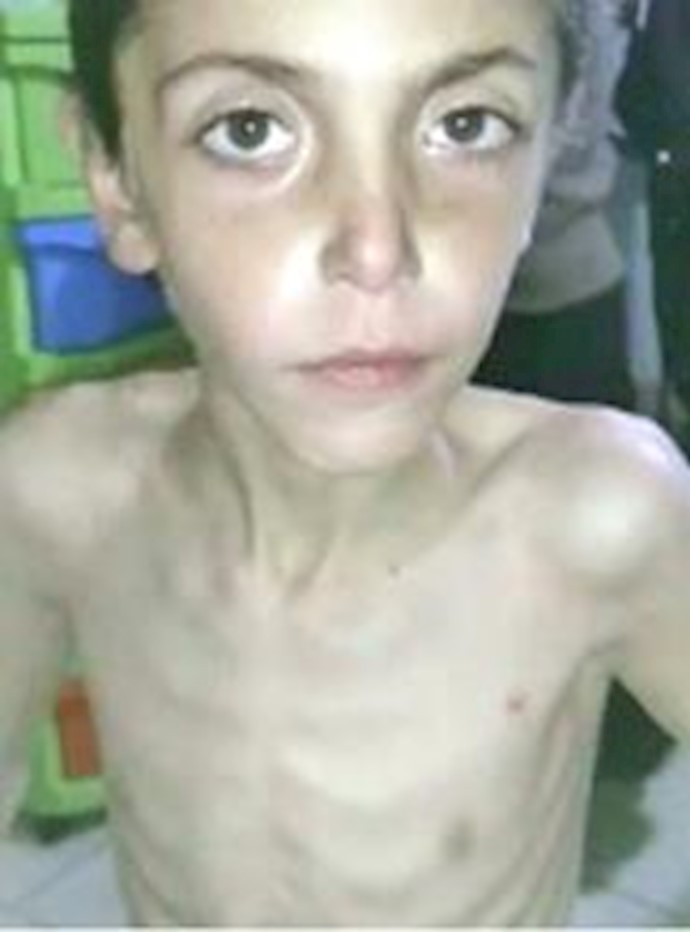 Syria: Fears for thousands starving, trapped in besieged Syrian town of Madaya surrounded by Bashar Assad’s Army