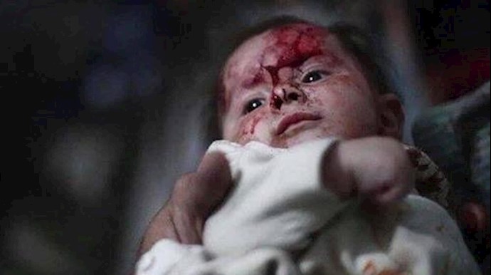  'The bloody face of a Syrian child injured in Assad and Russian bombings of Aleppo'