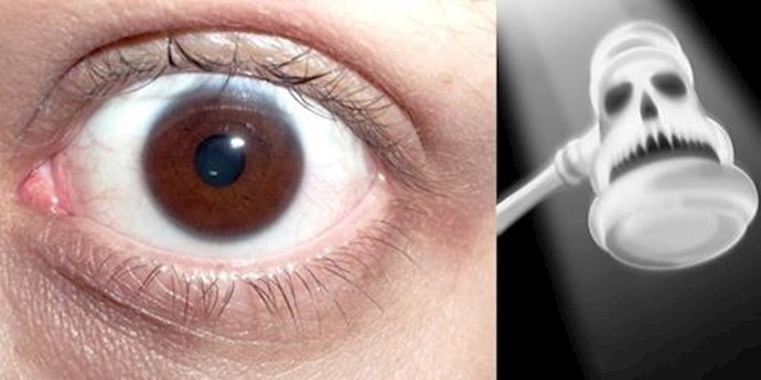 Iranian regime Supreme Court sentenced a man to have his eye gouged out