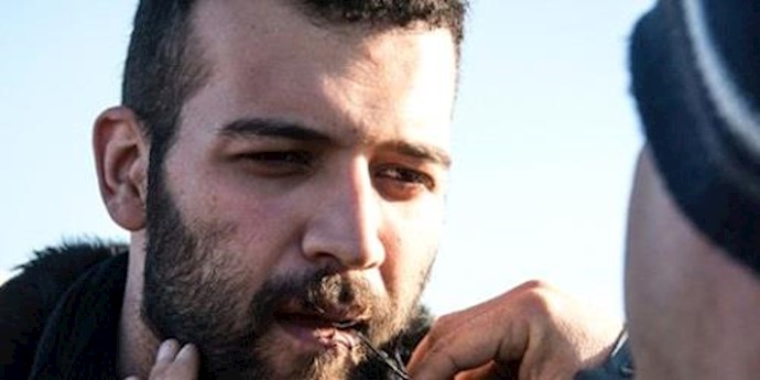 Calais ’Jungle’ Iranians who sewed mouths shut end hunger strike