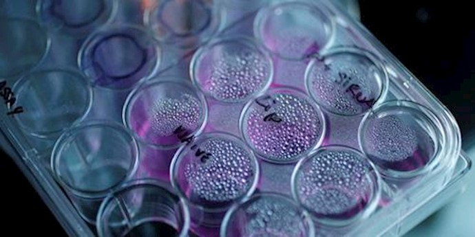  'A tray containing cancer cells in the Nanomedicine Lab at UCLs School of Pharmacy in London  '