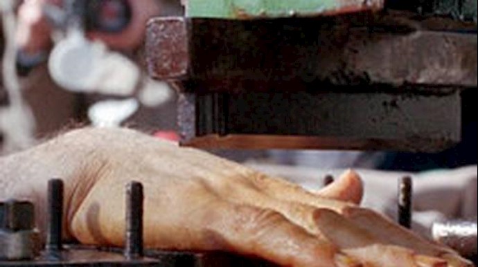 Iran amputates as punishment hand of a defendant