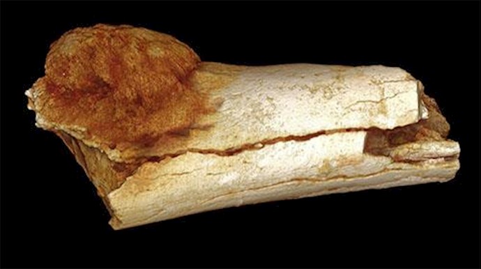 1.7 million-year-old cancer found, the oldest yet