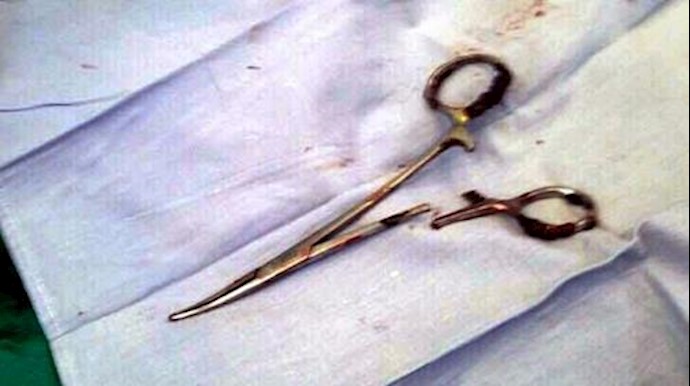 Scissors pulled from Vietnam man’s stomach 18 years after surgery