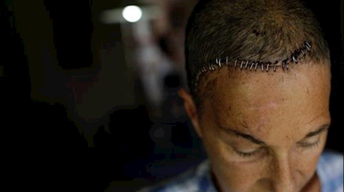 Venezuela’s injured activists struggle to heal